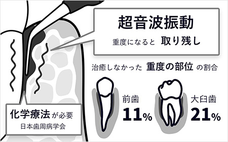 従来の治療方法との違い