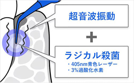 従来の治療方法との違い